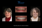 Combination Case by Dr. Arturo Garcia