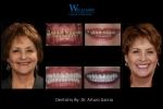 Extreme Makeover by Dr.Arturo Garcia