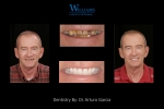 Smile Makeover by Dr. Arturo Garcia